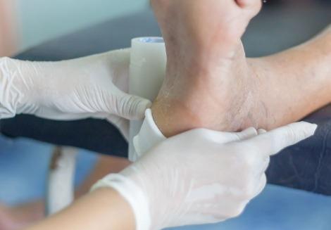 MPAM realiza lançamento do Sistema de atendimento ao pé diabético nesta quinta-feira