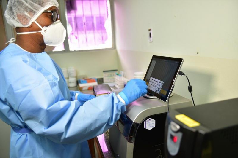 Amazonas amplia rede de diagnóstico de Covid-19 por biologia molecular