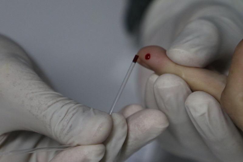 FVS-AM orienta farmácias sobre Testes Rápidos para Covid-19 e estabelece sistema de notificação de casos