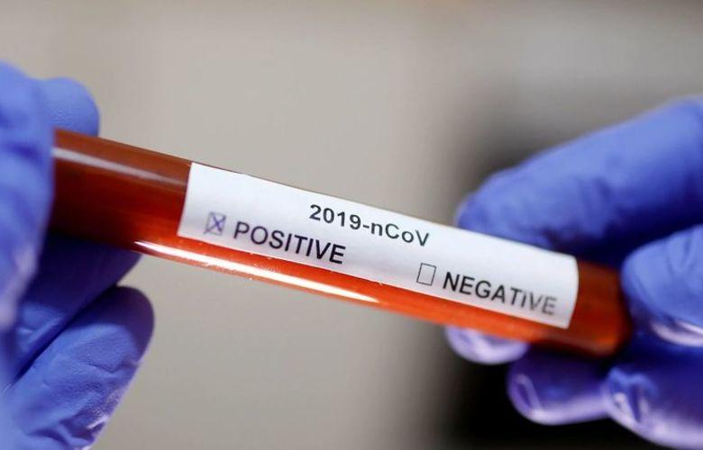 Casos confirmados de Covid-19 em Parintins chegam a 673 Casos confirmados de Covid-19 em Parintins chegam a 673
