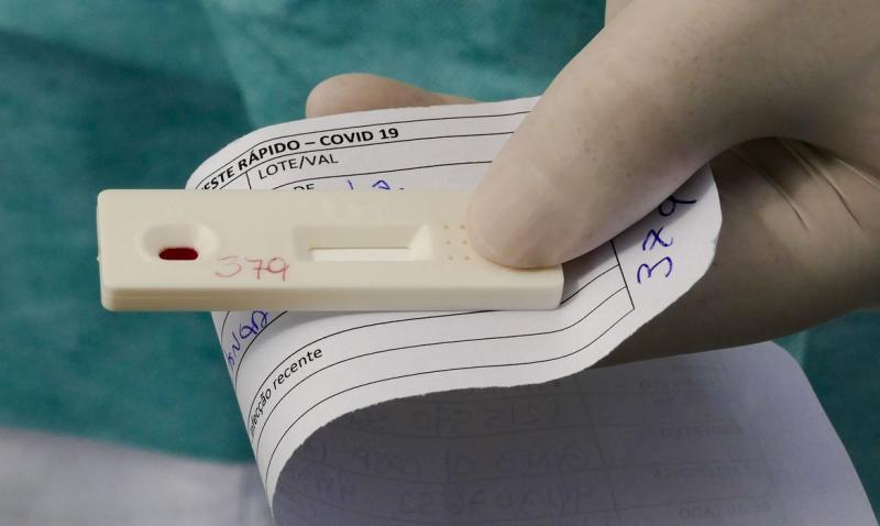 ANS decide amanhã se teste para covid-19 é procedimento obrigatório de planos