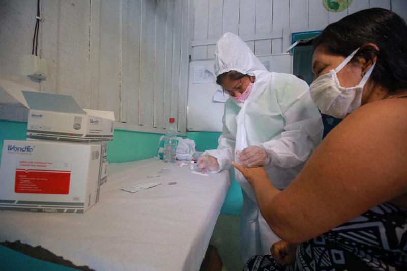 Amazonas está entre os estados brasileiros que mais realizam testes para Covid-19