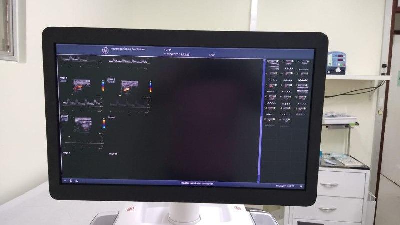 Hospital Francisca Mendes realiza primeiro exame de Ecocardiograma 3D do Amazonas