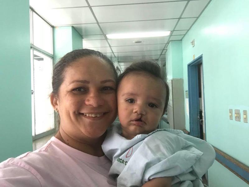 Hospital Dr Fajardo inicia triagem para cirurgias em crianças com lábio leporino Hospital Dr Fajardo inicia triagem para cirurgias em crianças com lábio leporino