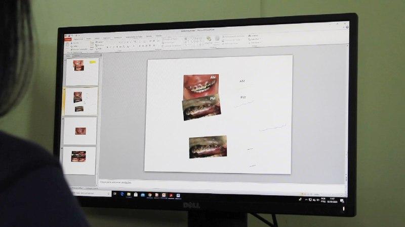 Peritos odontolegistas do AM usam sorriso de 'selfies' para identificação de corpos em decomposição
