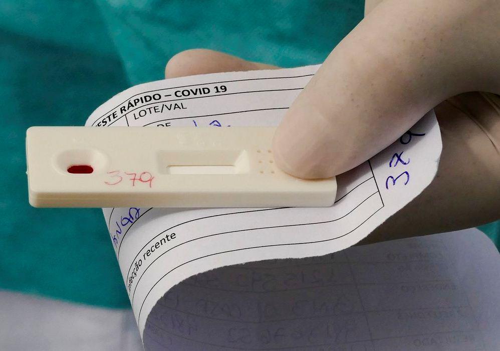 Covid-19: Brasil tem 5,35 milhões de casos e 156,4 mil mortes