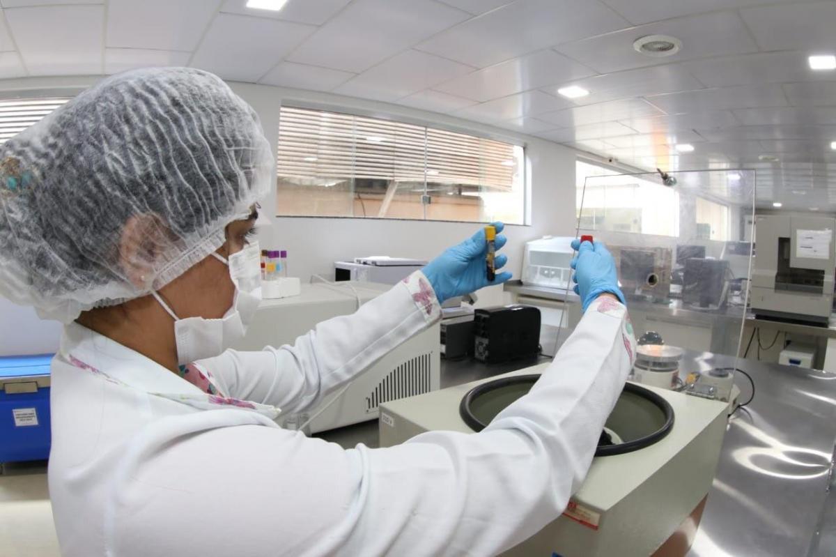 Estudo mundial de vacina contra o HIV recruta voluntários em Manaus