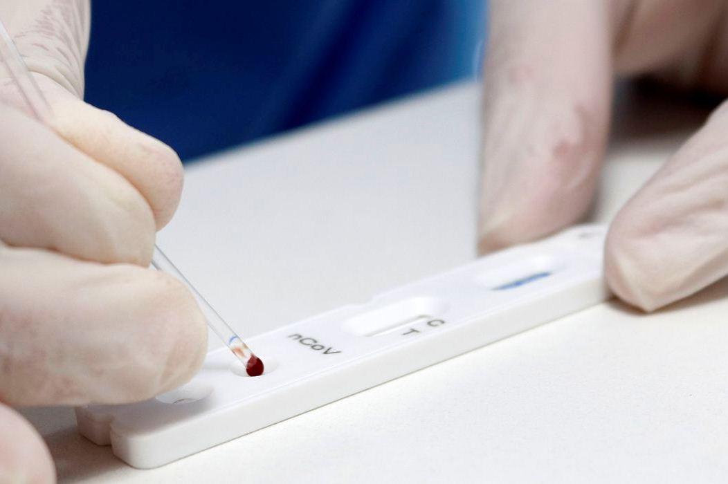 Covid-19: Brasil tem 179,7 mil mortes e 6,78 milhões casos acumulados