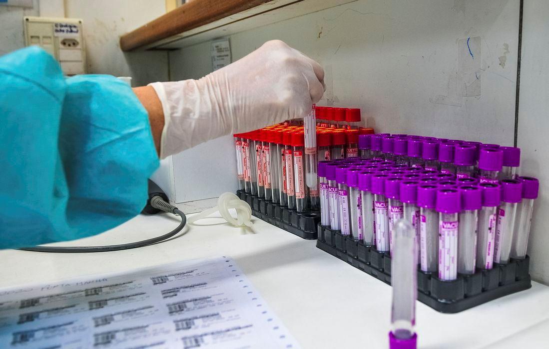 Pesquisa aponta provável ligação entre Covid-19 e disfunção erétil