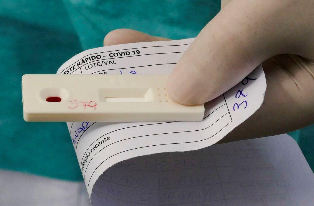 Brasil tem 8,1 milhões de casos acumulados de Covid-19