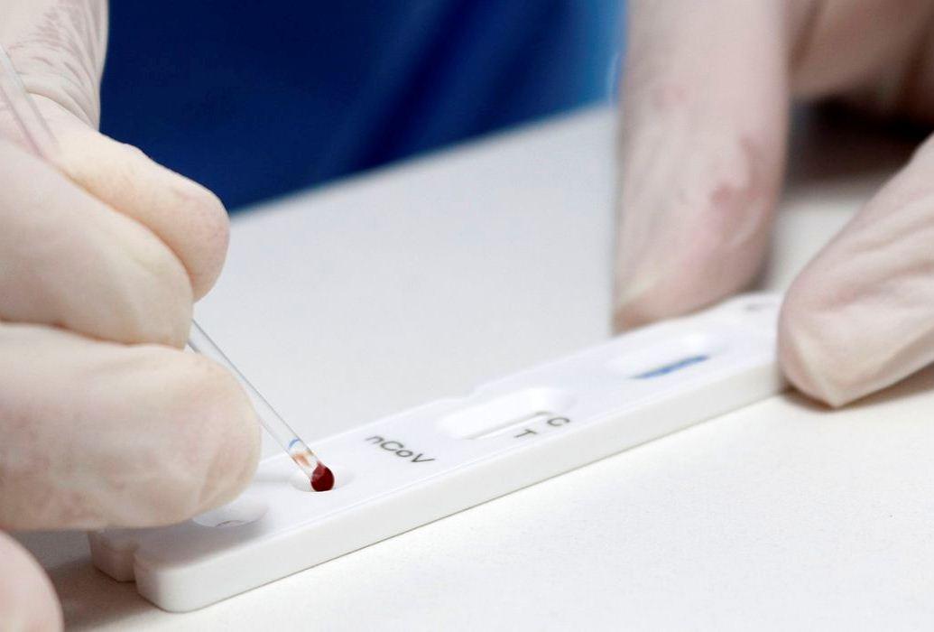 Covid-19: mortes somam mais de 226 mil e casos, 9,2 milhões