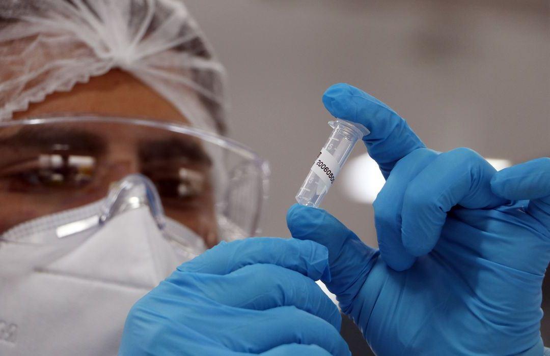 Covid-19: Brasil registrou 62.715 infectados em 24 horas