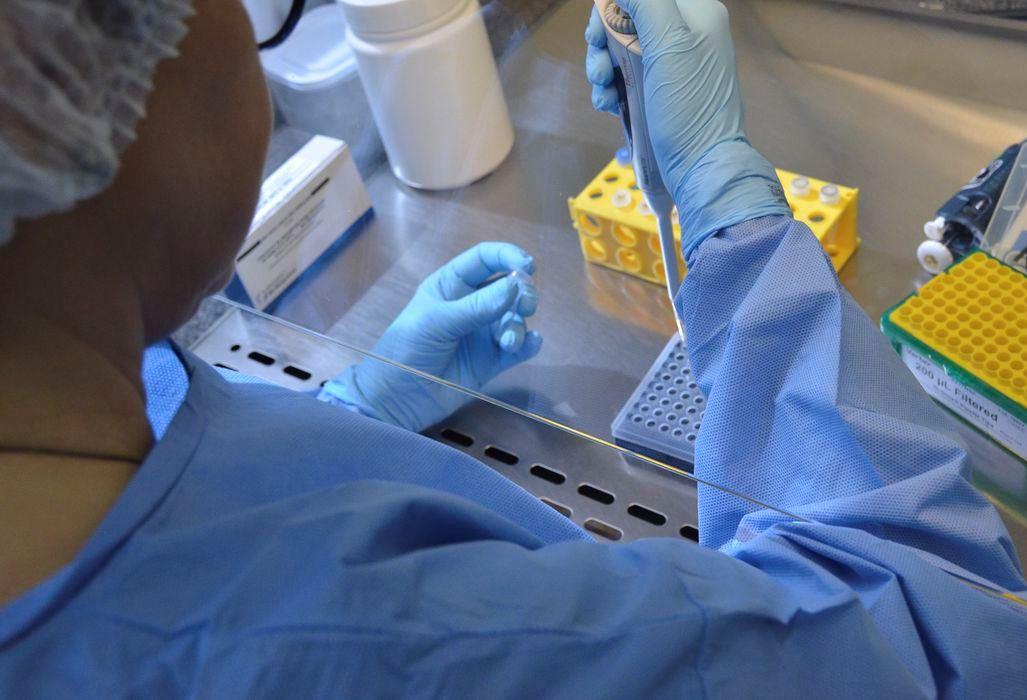 Testes de vacina contra HIV apresentam resultados promissores