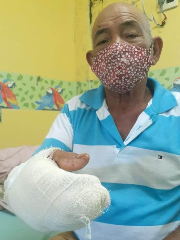 Em Barreirinha, homem de 72 anos é atacado por jacaré e segue internado no hospital da cidade