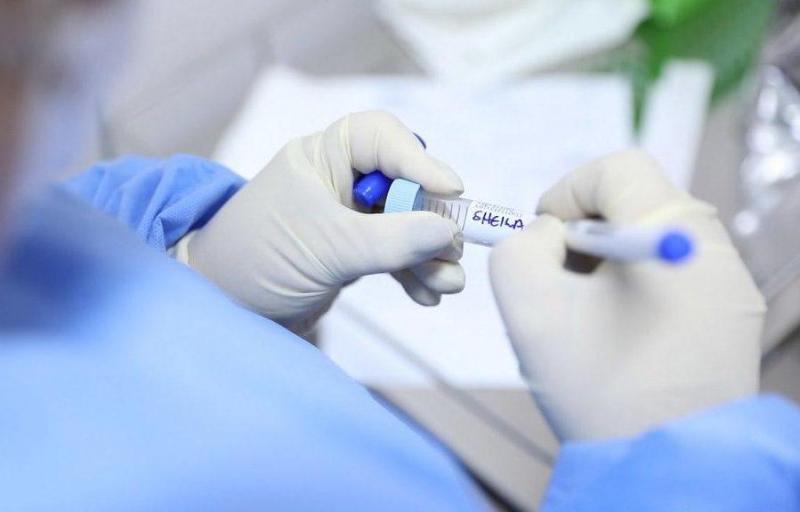 Boletim da FVS-AM traz o diagnóstico de 599 novos casos de Covid-19 e 13 óbitos pela doença