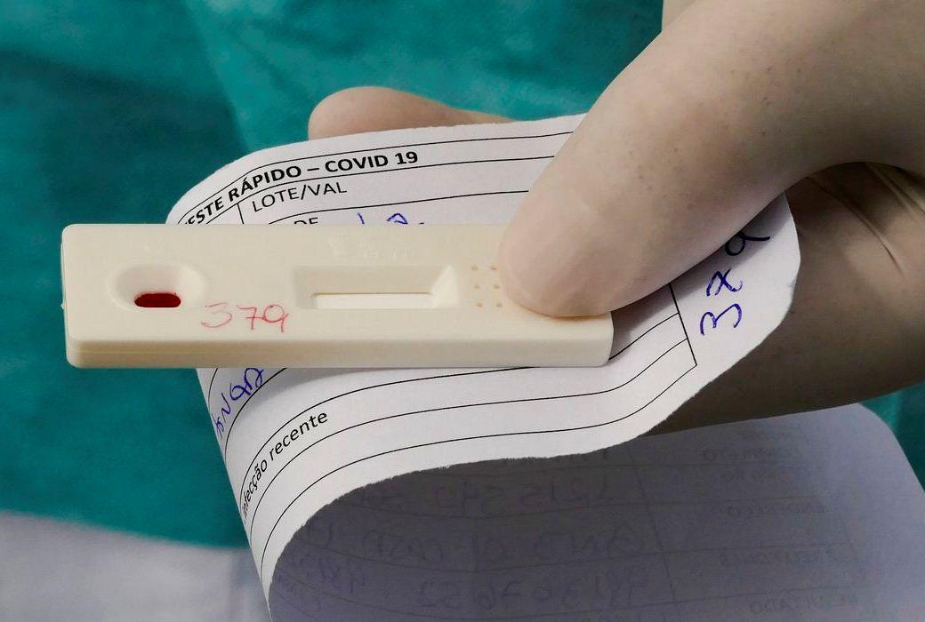 Brasil tem 15,2 milhões de casos confirmados da Covid-19