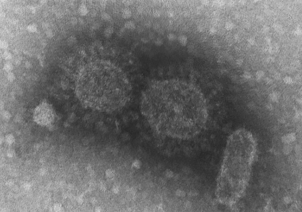 Instituto confirma variante indiana em navio ancorado no Maranhão