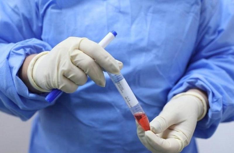 Amazonas registra 456 novos casos da Covid-19, totalizando 388.750 diagnósticos positivos da  doença no estado