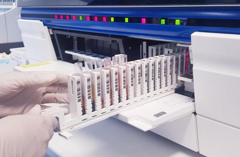 Laboratório do Hospital Delphina Aziz já realizou mais de meio milhão de exames em 2021