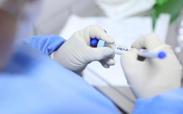 Amazonas registra 503 novos casos de Covid-19