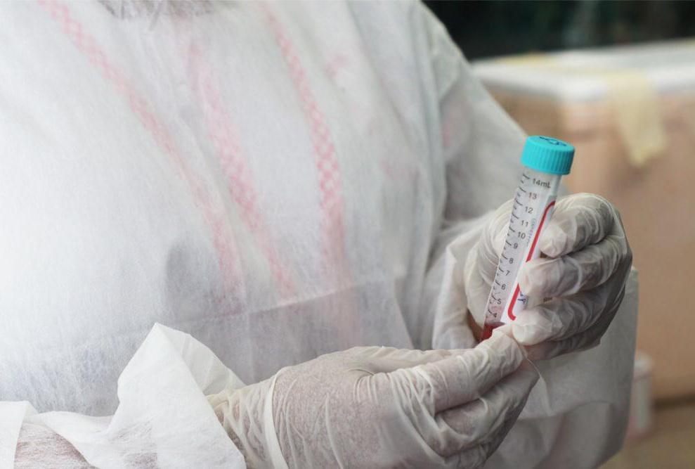 Amazonas registra 720 novos casos de Covid-19 nesta terça-feira (22)