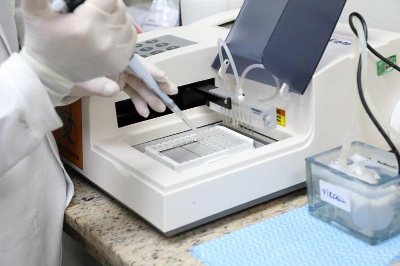 Em 24 horas, Amazonas registra 575 novos casos de Covid-19; foram 10 óbitos pela doença