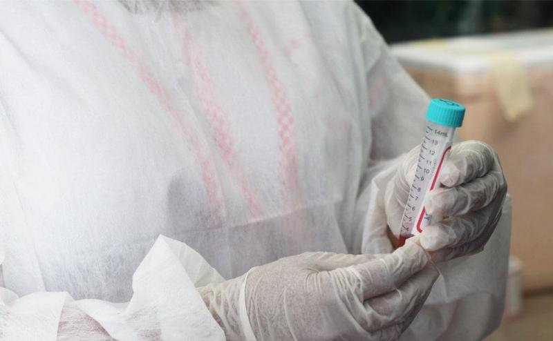 Amazonas registra de 231 novos casos de Covid-19 nesta segunda-feira (26)