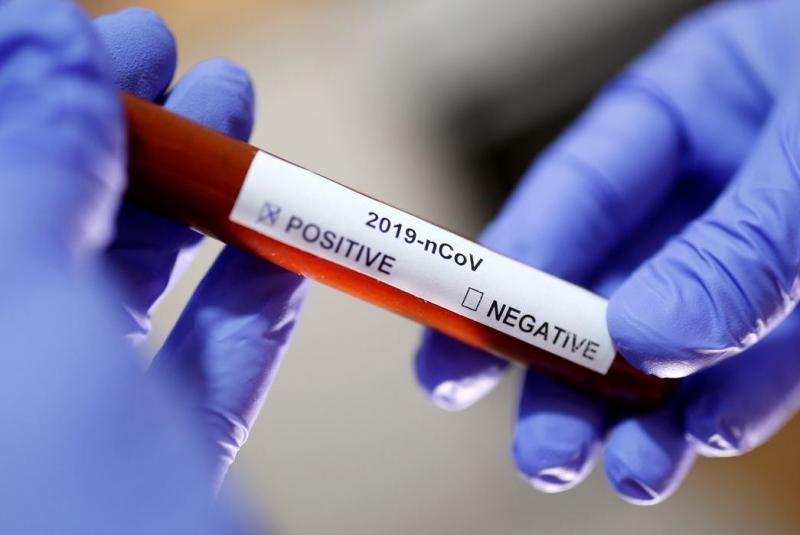 Número de mortes por Covid-19 diminuem, mas casos aumentam , diz Fiocruz