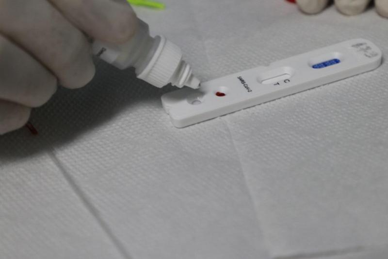 Nota Técnica da FVS-RCP restringe Teste Rápido de Anticorpos a diagnóstico de SIM-P Nota Técnica da FVS-RCP restringe Teste Rápido de Anticorpos a diagnóstico de SIM-P