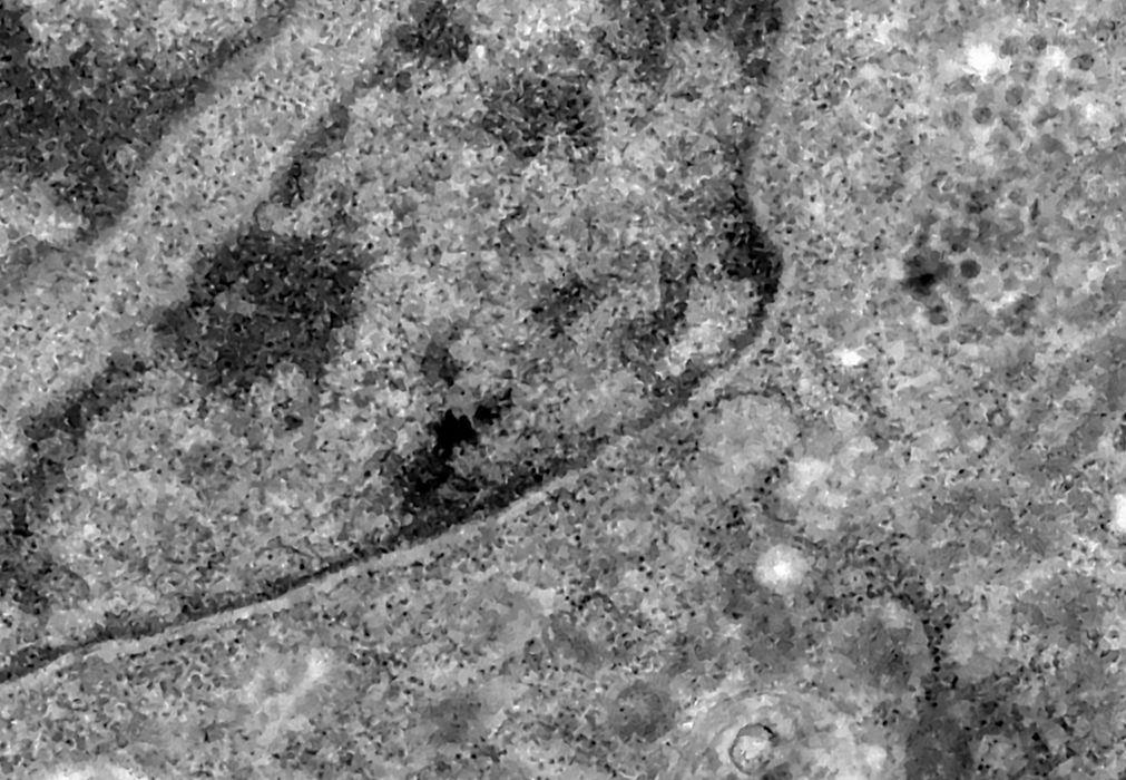 Pesquisa detecta coronavírus pela análise de retina