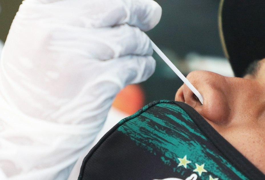 Amazonas registra 587 novos casos da Covid-19 nesta quarta-feira (04)