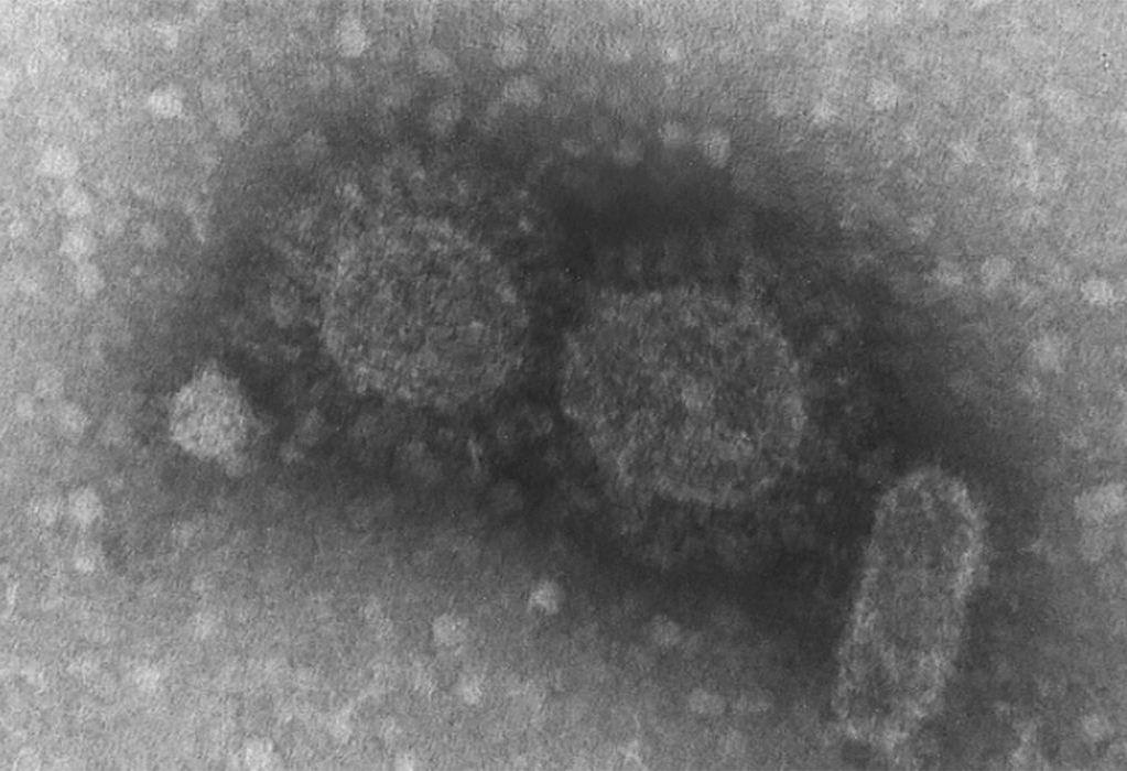 Brasil registra 570 casos de infecção pela variante Delta 