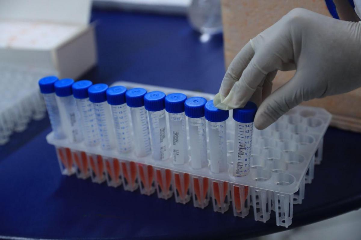 Amazonas registra 177 novos casos de Covid-19 em 24h