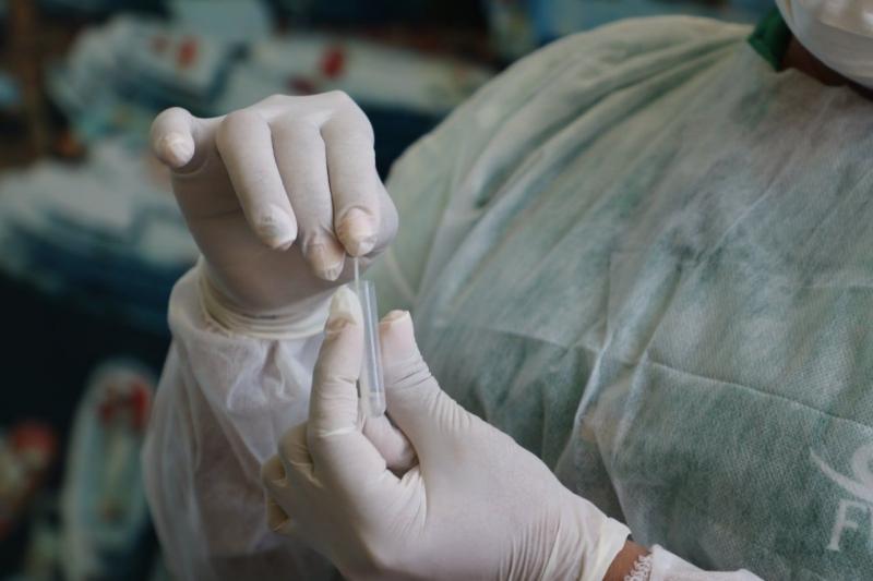 Amazonas registra queda no número de casos de Covid-19; em 24 horas foram 63