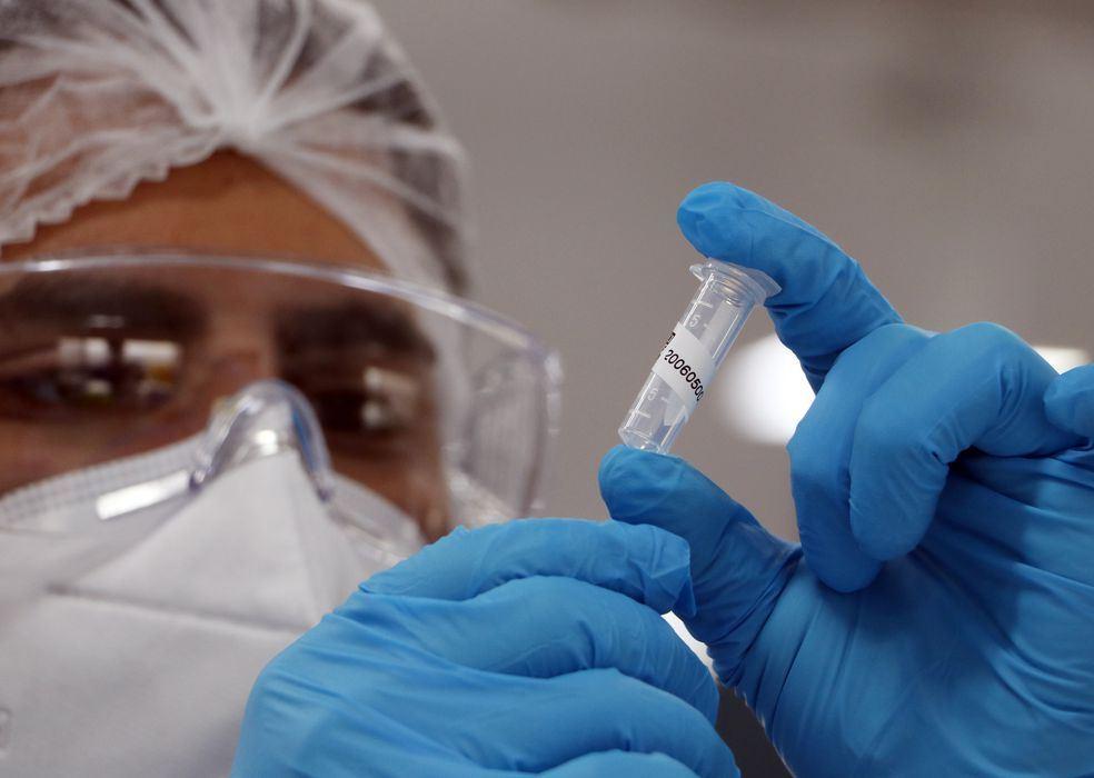 Síndrome respiratória aguda grave mostra tendência de queda