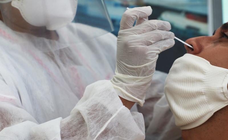 Amazonas registra 18 novos casos da Covid-19, nesta segunda-feira (1º)