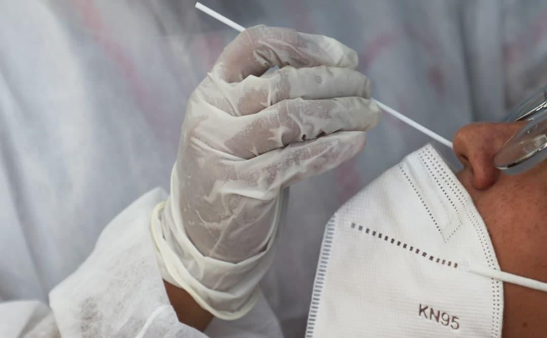 Amazonas registra 113 novos casos de Covid-19, nesta segunda-feira (08)