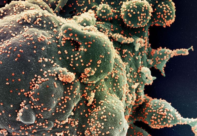 OMS diz que Ômicron é 'bastante infecciosa', mas não deve haver pânico