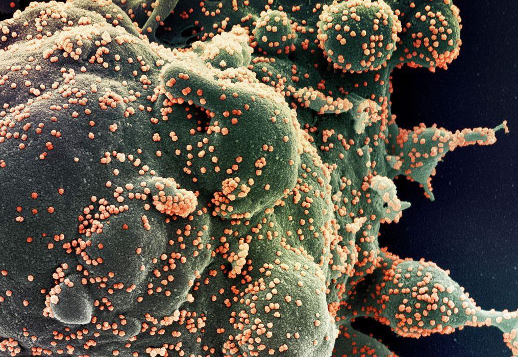 Remédio da GSK-Vir funciona contra mutações da variante Ômicron, diz estudo