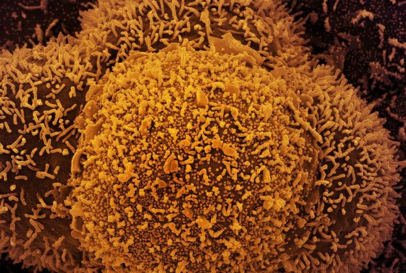 Epidemiologista diz que mundo enfrenta um ‘tsunami de infecções’, tanto da variante Delta quanto da Ômicron