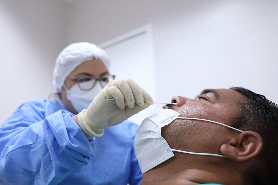 Amazonas registra 67 novos casos de Covid-19, em 24h