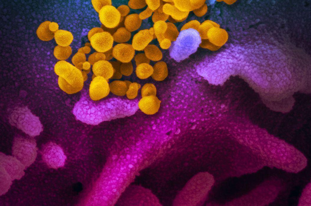 Brasil bate recorde de novos casos da Covid-19 pelo segundo dia seguido