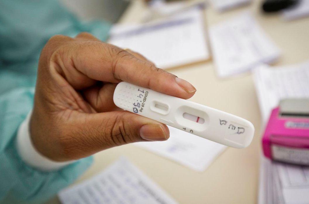 Anvisa aprova uso e comercialização de autoteste para Covid-19