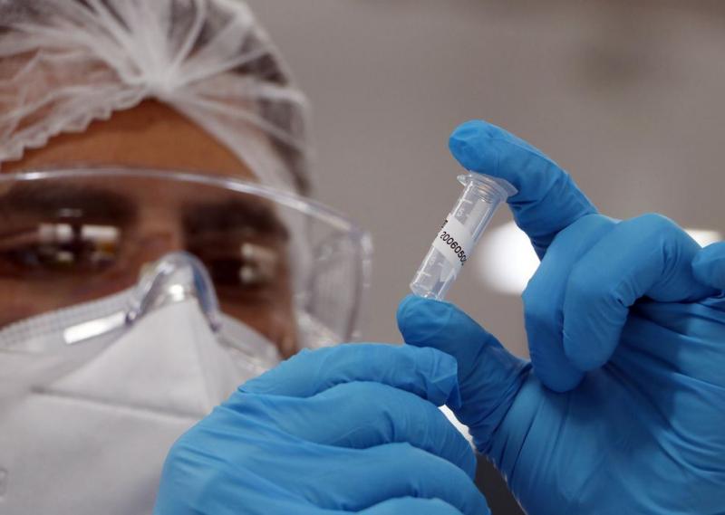 Ministério da Saúde confirma o quinto caso da subvariante BA.2 da Ômicron no Brasil