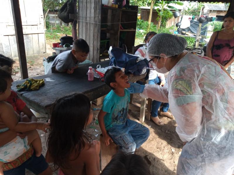 Pesquisa Nacional de Saúde Bucal no Amazonas inicia na primeira quinzena de abril