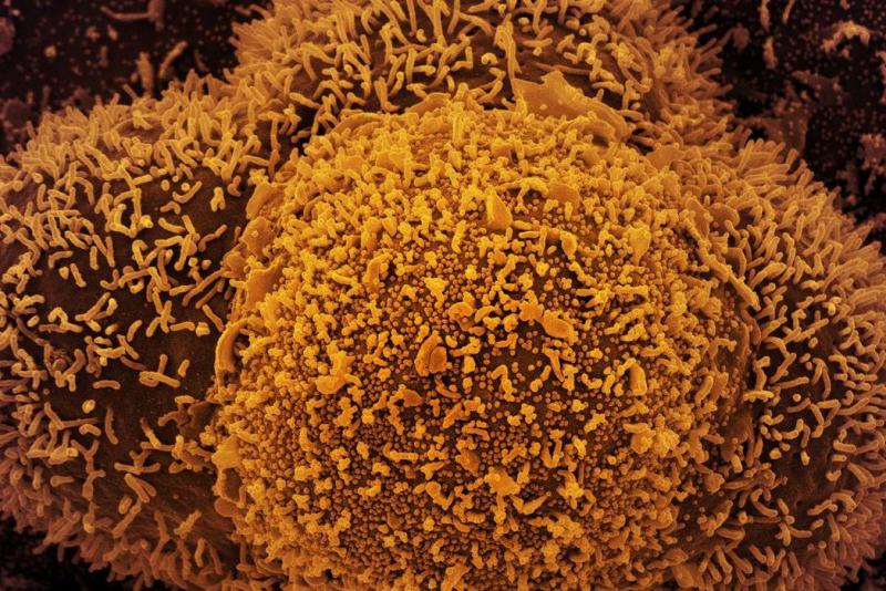 Desde o início da pandemia, Brasil registra 655,2 mil mortes pela Covid-19