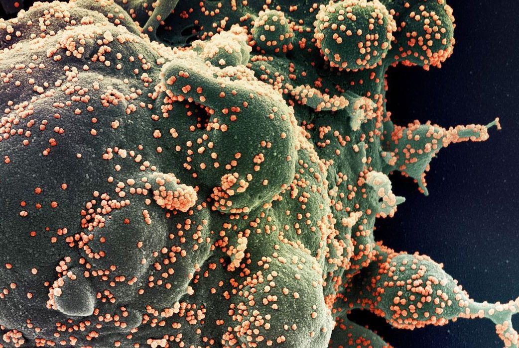 Casos acumulados de Covid-19 passam de 30 milhões no Brasil