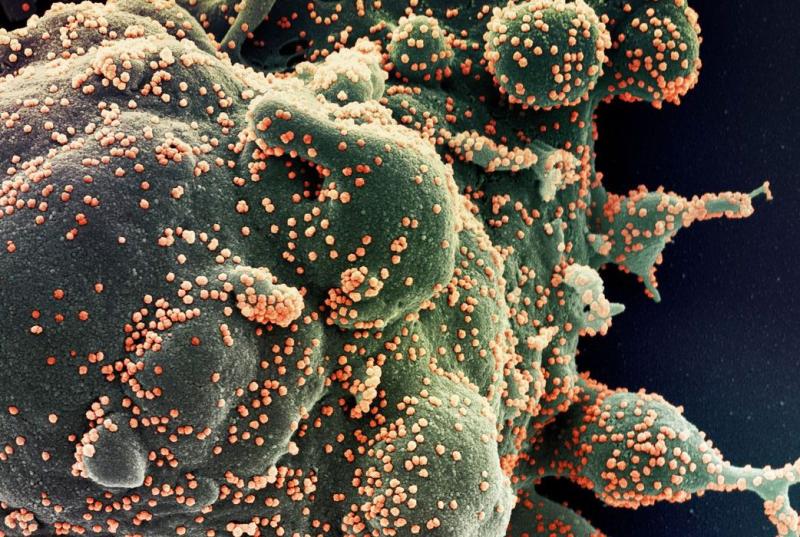 Brasil registra 13,5 mil novos casos de Covid-19 e 69 mortes pela doença, em 24 horas