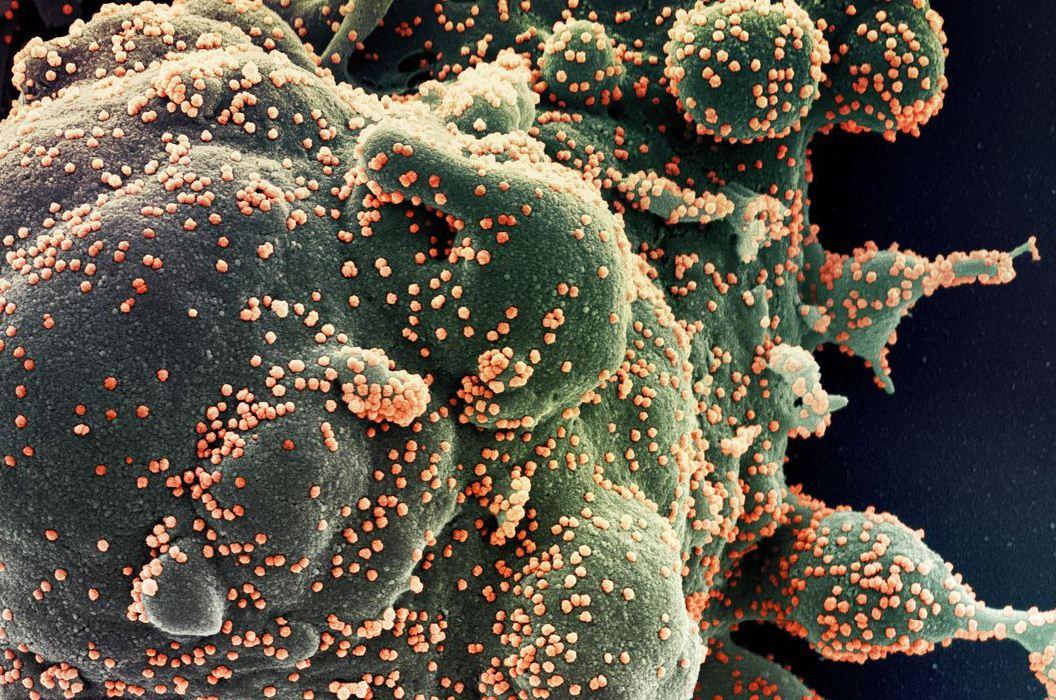 Brasil registra 33,9 mil novos casos da Covid-19 em 24 horas