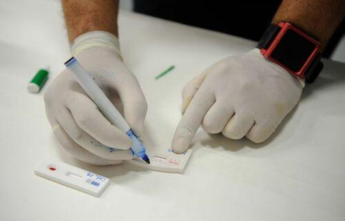 Brasil teve mais de 690 mil casos de hepatites confirmados entre 1999 e 2020